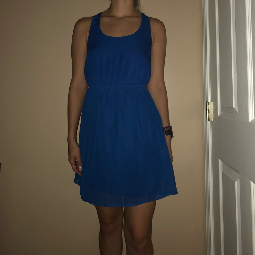 Cage back dress